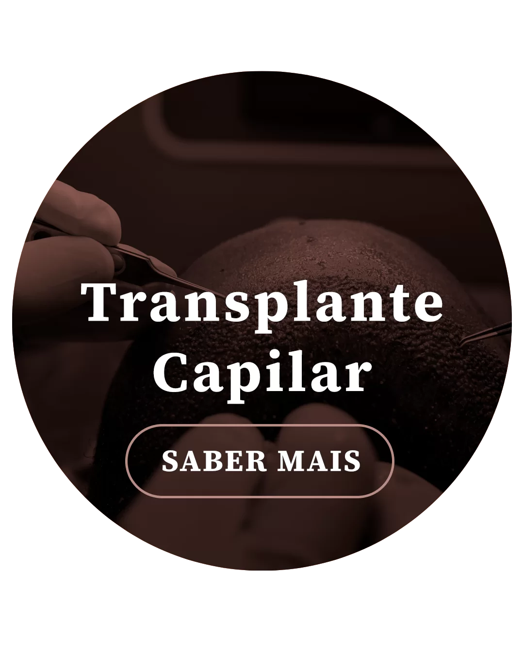 Dra. Priscila Brandão. Um transplante de cabelo é um procedimento cirúrgico para preencher áreas sem cabelo com seu próprio cabelo. É um trabalho delicado que requer atenção a todos os detalhes. A sensibilidade deste médico é necessária para a coordenação entre o transplante capilar e o rosto do paciente. A “linha do cabelo”, ou linha frontal, deve apresentar irregularidades suaves e delicadeza na implantação das unidades foliculares. Com todo cuidado e de forma minimamente invasiva, a Dra. Priscila Brandão fará o transplante de folículos pilosos em áreas que existem pouco ou nenhum cabelo. Durante a sua consulta em Fortaleza, você será explicado passo a passo sobre como vai funcionar o seu procedimento. A Dra Priscila avaliará sua área doadora e receptora minuciosamente, além de ver a saúde do couro cabeludo. Ela irá entender suas expectativas e alinhar com a realidade do procedimento para encontrar com você a melhor experiência possível.